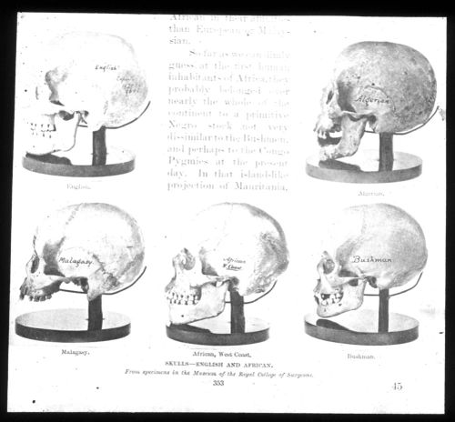 Comparison of different skills